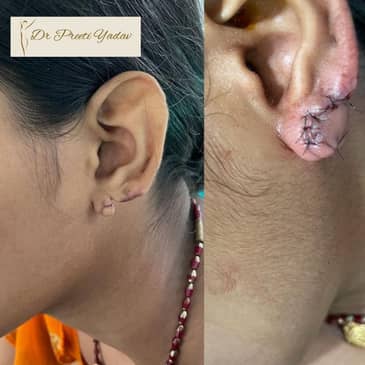 Slider image (4) Konarc Aesthetics - Plastic & Cosmetic Surgery In Gurgaon, India.